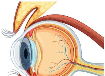 مهمترین علل کم بینایی؛ این بیماری بینایی و دید مرکزی را تار می نماید